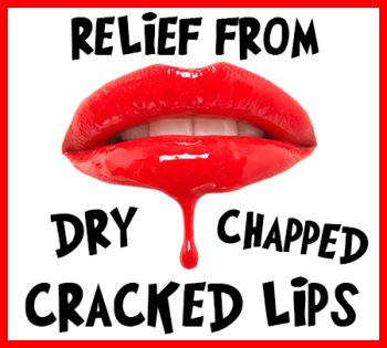 Waukee dentists at Lush Family Dental tell you how to relieve your dry, chapped, and cracked lips!